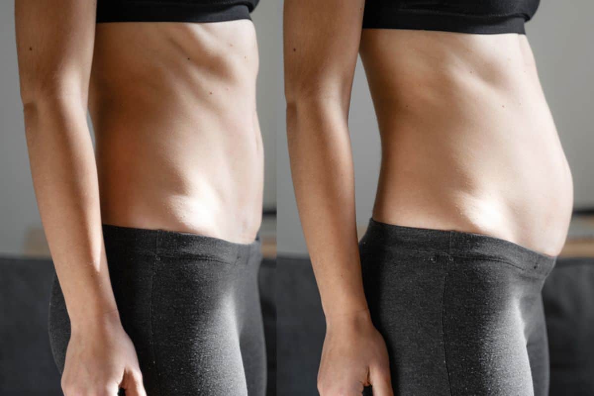 How long does diastasis recti take to improve Southend-on-Sea?