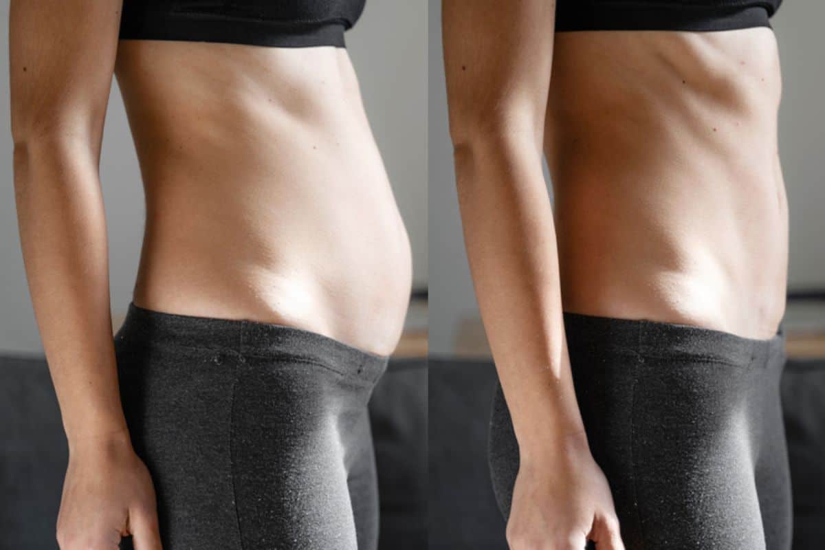 Post-Pregnancy: What Happens to Your Abdominal Muscles After Birth Southend-on-Sea