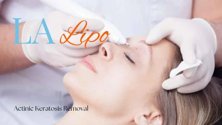 Woman receiving Actinic Keratosis Removal Treatment Southend-on-Sea