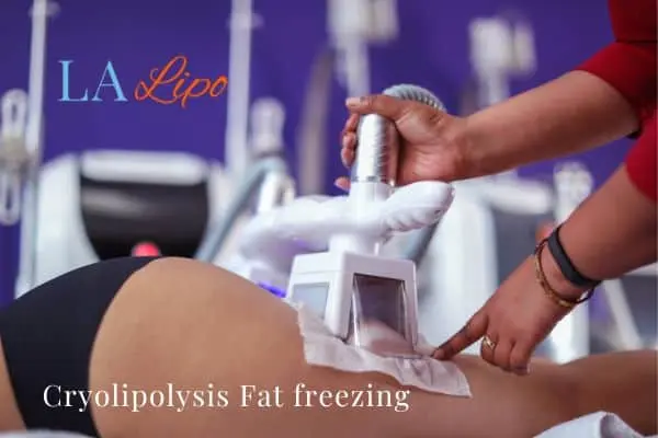women getting fat freezing Southend-on-Sea