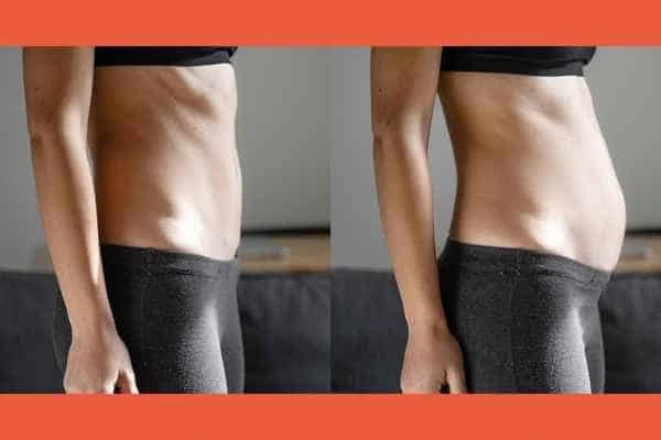LA-EMS Body Sculpting results Southend-on-Sea