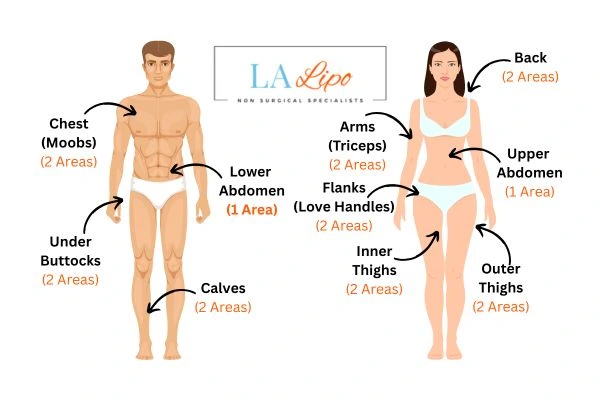 LA LIPO Cryolipolysis Areas Southend-on-Sea