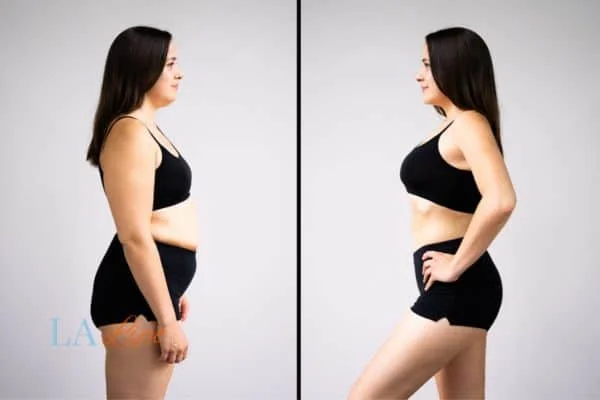 link between body image and mental health Southend-on-Sea