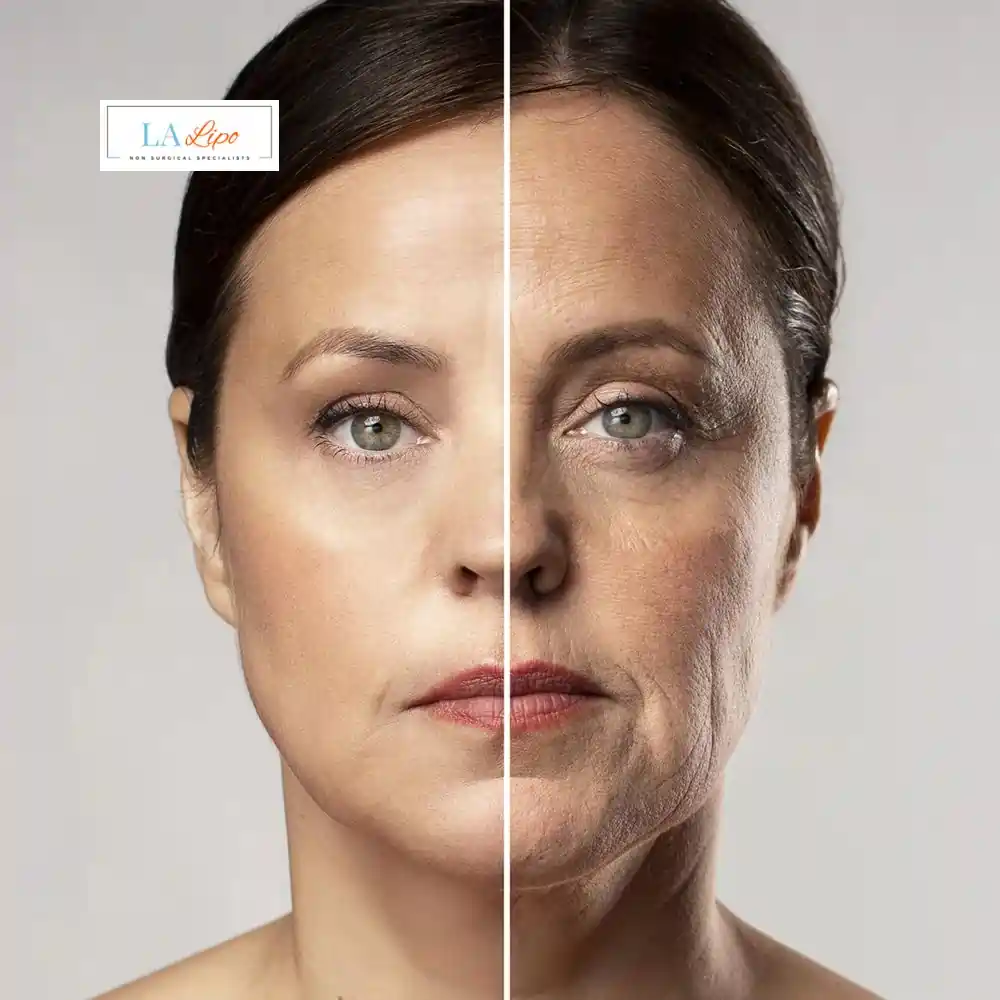 How Can You Tell If Non-Surgical Skin Tightening Is Right for You Southend-on-Sea?