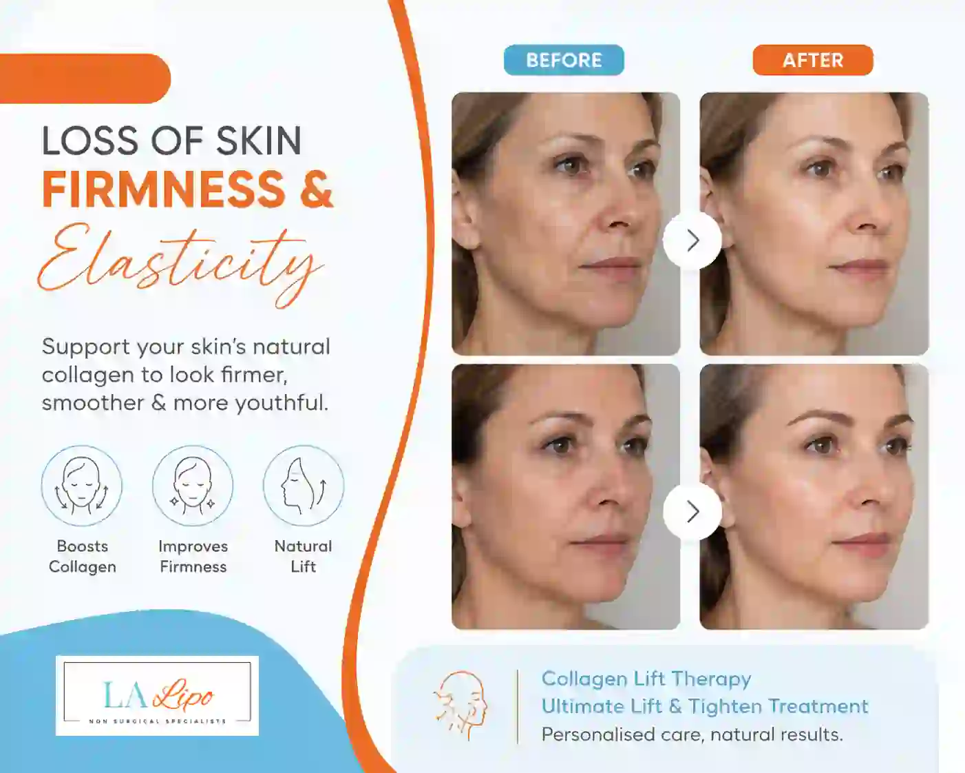 Sign #7: Loss of Skin Firmness and Elasticity Southend-on-Sea