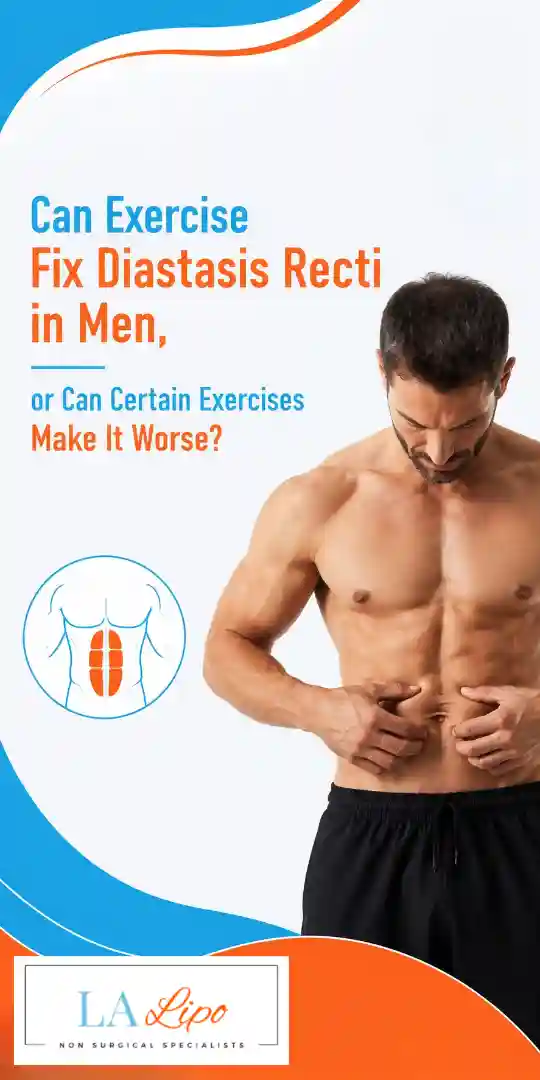 Can Exercise Fix Diastasis Recti in Men, or Can Certain Exercises Make It Worse Southend-on-Sea?